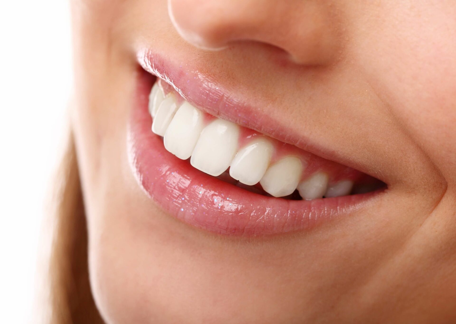Teeth whitening