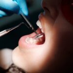Types of Sedation Dentistry