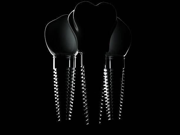 a dramatic photo of dental implants