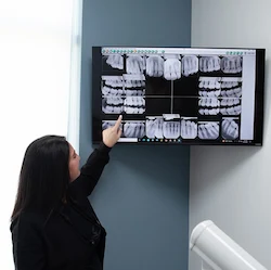 adv cim dental restorations
