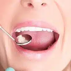 checkup and cleaning 2