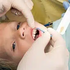 checkup and cleaning 4