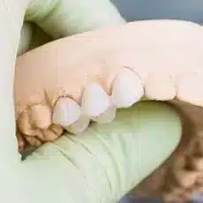 missing teeth 2.webp